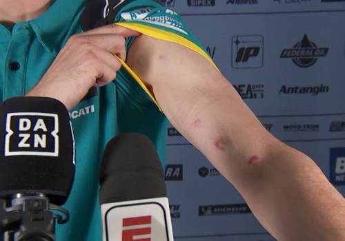 Skandal po rundzie MŚ w Brazylii. Zawodnicy pokazali obrażenia