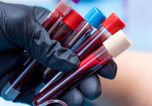 Pobierała im krew do badań i nic o tym nie wiedzieli? Skandal w polskim szpitalu