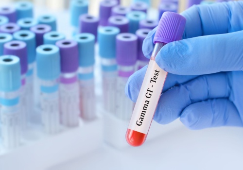 Przyczyny i skutki podwyższonego GGTP. Co to oznacza i jak je obniżyć?   