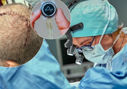 Klikanie myślami: Jak Neuralink Elona Muska przenosi granie na nowy poziom