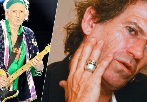 Keith Richards zmaga się z artretyzmem. 