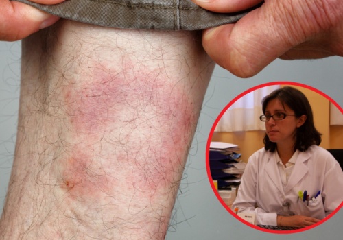 Coraz więcej pacjentów u lekarzy POZ. Nadchodzi armagedon