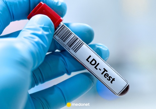 Mam podwyższony cholesterol, co dalej? Kardiolog: zawsze pytam o jedną rzecz