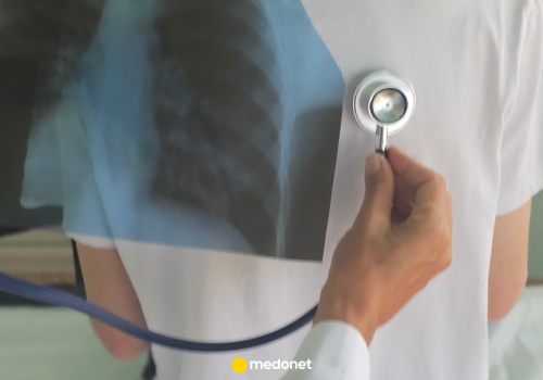 Gruźlica wraca do Polski. Ponad 1/3 pacjentów przerywa leczenie