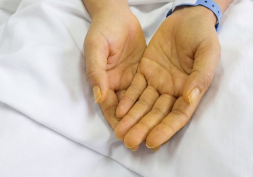 Żółta skóra – czego może być objawem? Sprawdź możliwe przyczyny