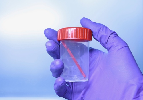 Śluz w kale: co może być przyczyną i kiedy stolec ze śluzem powinien niepokoić?