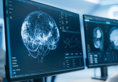 Jego zdaniem OpenAI nie osiągnie przełomu w AI. Ma inny, zaskakujący pomysł, na który postawił miliard dolarów