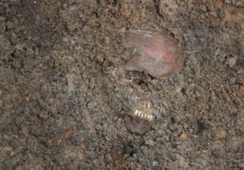 Czerwone kości żołnierzy z I wojny. Naukowcy poznali powód