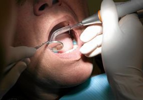 Hurtownia przysłała stomatolożce paczkę, a w niej ostrzeżenie: 