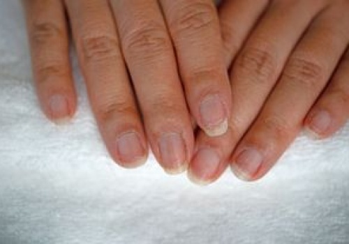 Masz czarną kreskę na paznokciu? Nie lekceważ. To ważny sygnał