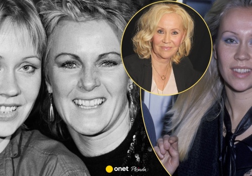 Ciemne strony sławy 