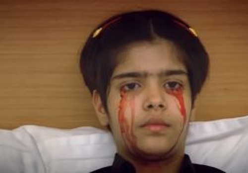 Dziewczynka płakała krwią. Rzadki przypadek medyczny