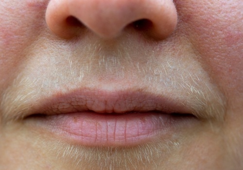 Zapomnij o depilacji. Tak usuniesz wąsik za grosze i bez wychodzenia z domu