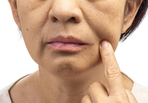 Ten krem to remedium na „chomiki” - modeluje owal twarzy, wypełnia zmarszczki i ujędrnia