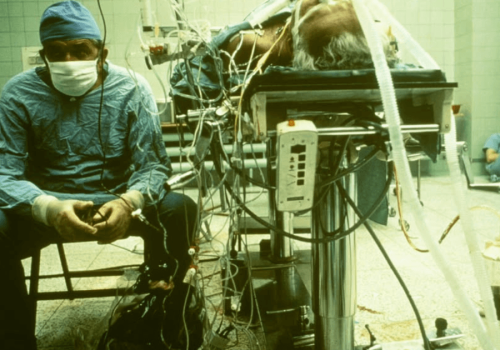 40 lat temu Religa przeprowadził pierwszy udany przeszczep serca w Polsce