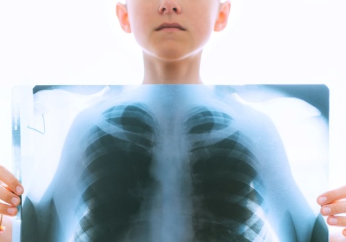 Ponad 180 dzieci przejdzie badania. Miały kontakt z nauczycielką chorą na gruźlicę