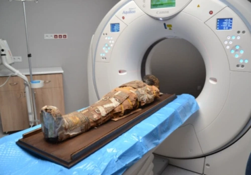 Egipska mumia prześwietlona przez polskich radiologów. Tomografia ujawnia tajemnice sprzed 2000 lat