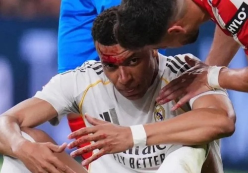Na boisku polała się krew. Kontrowersja i niespodziewany wynik Realu Madryt
