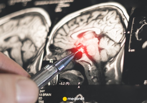 Liczba chorych stale rośnie. 