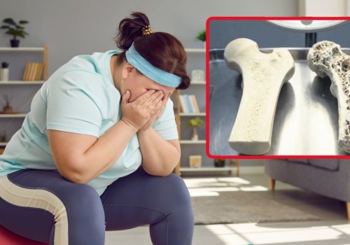 Ozempic rozpuszcza kości? Z małego badania powstał wielki mit