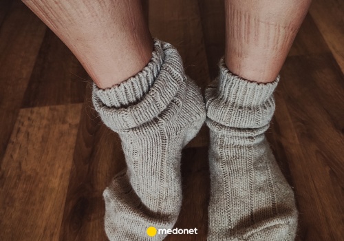 Zostają ci ślady po skarpetkach? Lekarze mówią, kiedy to może być coś poważniejszego