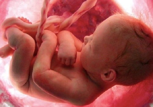 Większa prawna ochrona życia dzieci służy też ich matkom