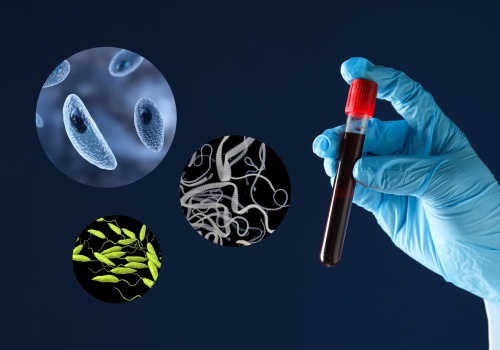 Badania krwi w kierunku chorób pasożytniczych – co wykrywają i kiedy należy je robić?