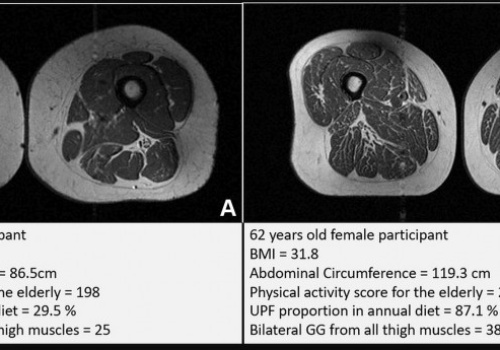 Jesz parówki, mrożoną pizzę i inną ultraprzetworzoną żywność? Osłabiasz swoje mięśnie