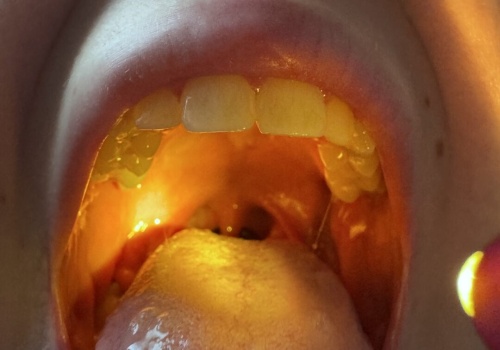 Nowe światło na źrenice dzieci, czyli recenzja latarki Mactronic MedLite