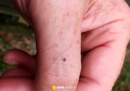 Ludzie często mylą je z pieprzykami. Są groźne tak samo, jak kleszcze