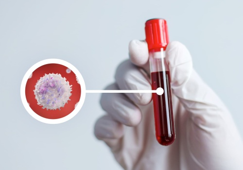 WBC w morfologii – co oznacza i jak interpretować wyniki? O czym świadczy obniżony lub podwyższony poziom?