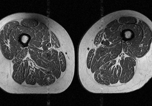 Ludzkie udo jak stek. Tak zmienia nas popularna żywność