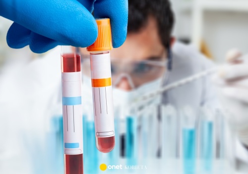 Jedna grupa krwi zwiększa ryzyko udaru. Naukowcy wciąż nie znają odpowiedzi