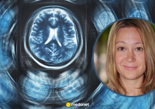 Neurolog zdradza siedem nawyków, które niszczą mózg