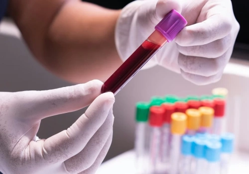 Nowe leki na białaczkę i chłoniaki w Polsce. Ministerstwo Zdrowia zapowiada możliwe decyzje refundacyjne