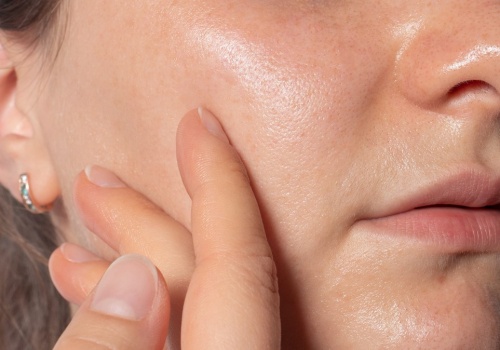 Zmniejsza widoczność porów jak laser. W aptece kosztuje kilka złotych