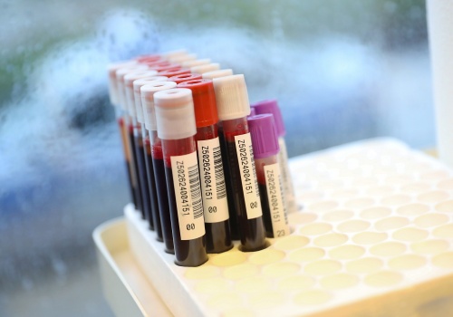 Krwiobus cały czas w trasie. Brakuje niemal wszystkich grup krwi