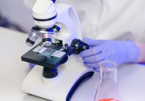 Mikrobiom jelitowy przewiduje nawrót czerniaka z dokładnością do 94% – diagnostyka przyszłości