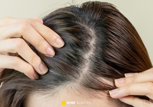 Ten szampon hamuje wypadanie włosów i pobudza cebulki. Rosną jak zaczarowane!