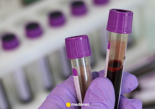 Nowe wytyczne na temat cholesterolu. To powinna wiedzieć każda osoba 30+