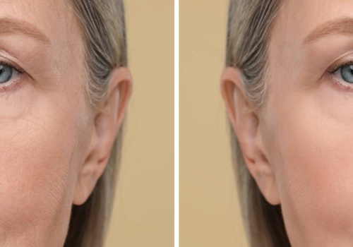 To serum to potężna dawka nawilżenia! Papierowe zmarszczki znikają już po 1. użyciu!