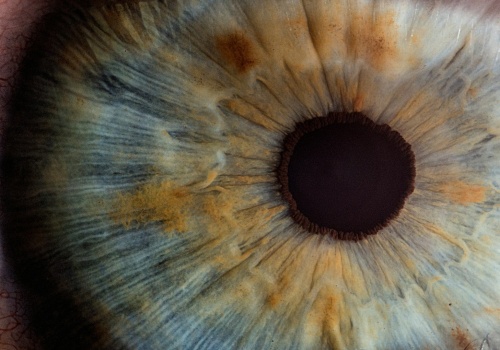 Dziedziczne choroby oczu wcale nie są takie pewne?