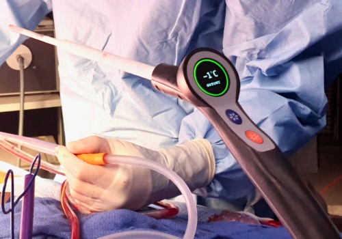 Rozpoczął się drugi proces due diligence w stosunku do produktu CoolCryo spółki Medinice