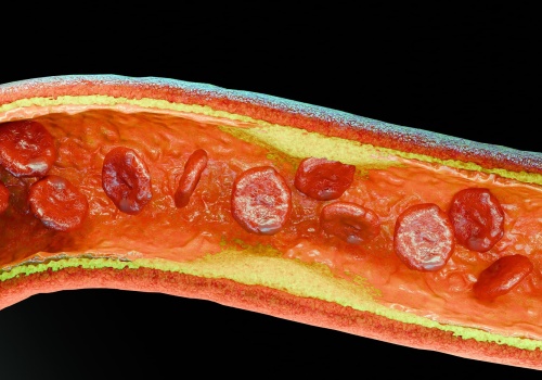 Cholesterol resztkowy – co to jest, jak go obliczyć i jak wpływa na zdrowie?