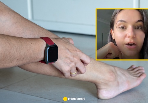 Objaw nasilał się nocą. Lekarze myśleli, że to świerzb. Nie rozpoznali nowotworu