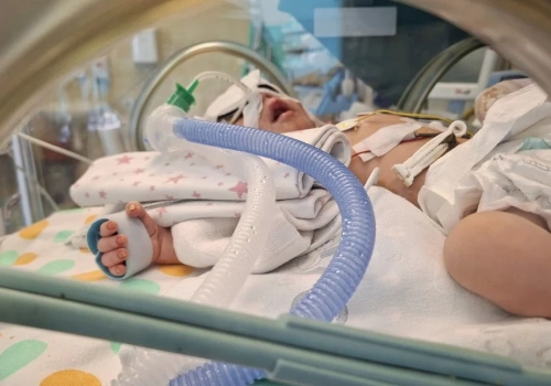 Legniccy neonatolodzy ratują życie małego pacjenta, który urodził się z oceną 1 punktu w skali Apgar