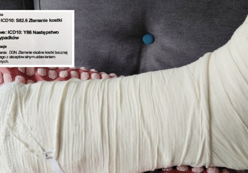 Złamał kostkę na parkingu. 