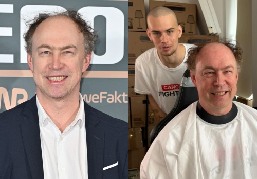 Michał Pol ogolił głowę. Zrobił to w szczytnym celu