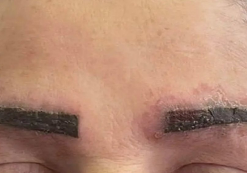 Popularny trend w makijażu wywołał u niej chorobę całego ciała. Lekarze ostrzegają