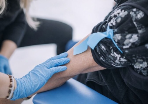 Badanie witaminy D w cenie 35 zł